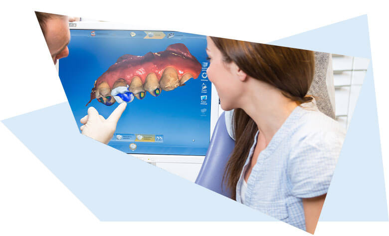 CEREC – Abdruckfreier Zahnersatz